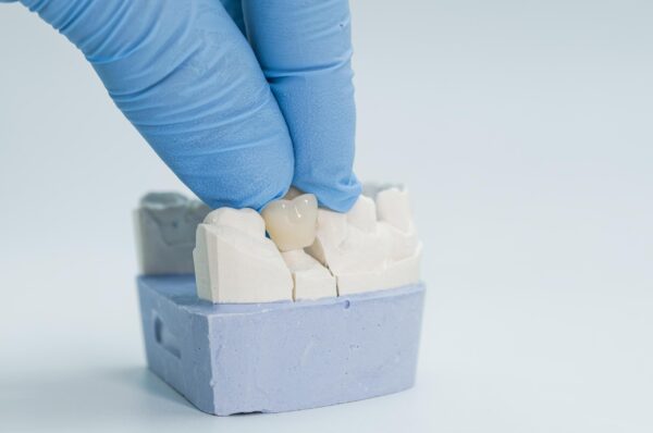 ¿Cubre Medicaid las coronas dentales para niños?
