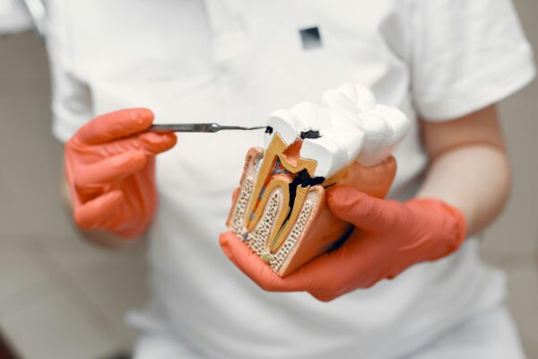 Dentista explicando una endodoncia.