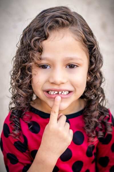 Infected Loose Tooth in a Child