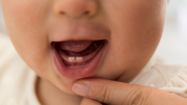 Pediatric Dental Specialist in Camelback